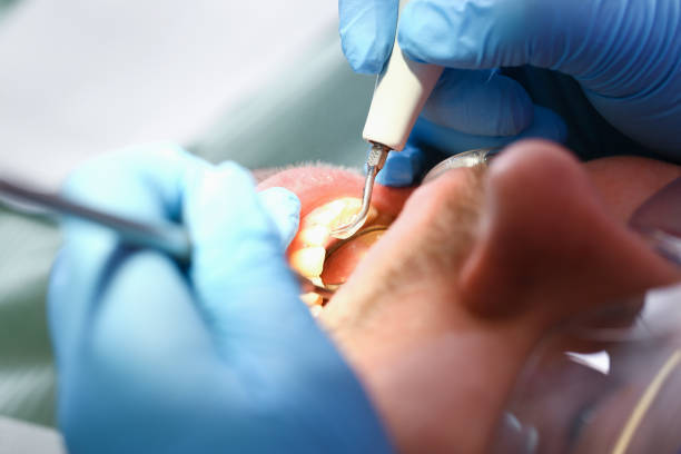 Best Walk-In Emergency Dental Services in Olmos Park, TX