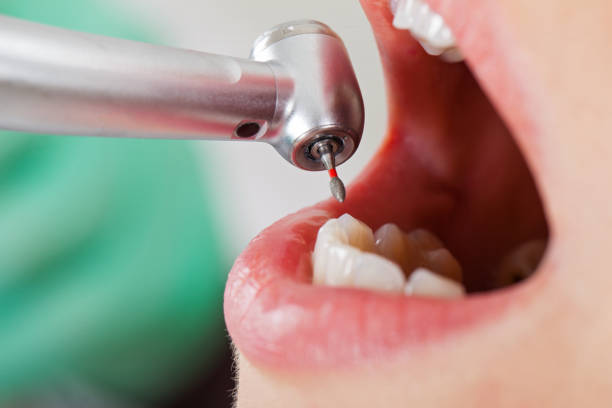 Best Emergency Treatment for Oral Infections in Olmos Park, TX